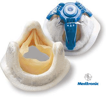 Image: The Mosaic bioprosthetic heart valve (photo courtesy of Medtronic).